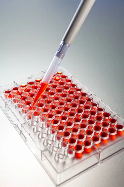 Rode oplossing of onderzoek van het bloed medisch laboratorium met een pipet en CE — Stockfoto