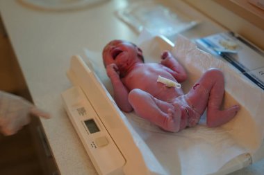 Göbek bağı olan yeni doğan Asyalı Çinli bebeğin yakın çekimi.