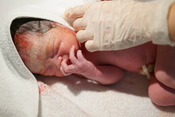 Close Newborn Asian Chinese Baby Umbilical Cord — Stock Photo, Image