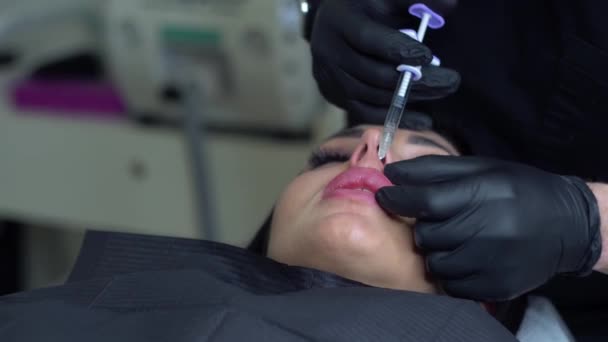 Хірург, в чорних медичних рукавичках, пробиває жіночу губу шприцом і повільно вводить гіалуронову кислоту. Доповнення губ. Пластична хірургія — стокове відео