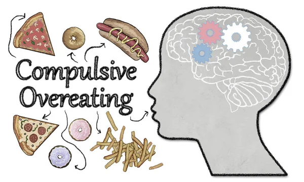 Compulsive Overeating Illustrated Junk Food Brain Activity White Background Stock Photo