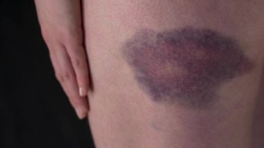 Büyük morluk üzerinde kadın vücut