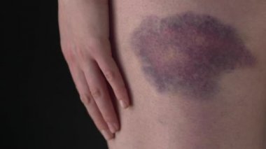 Bir morluk Ile kadın