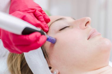Hardware cosmetology, mesotherapy, Close up of young woman getting treatment of cheek zone at spa. clipart