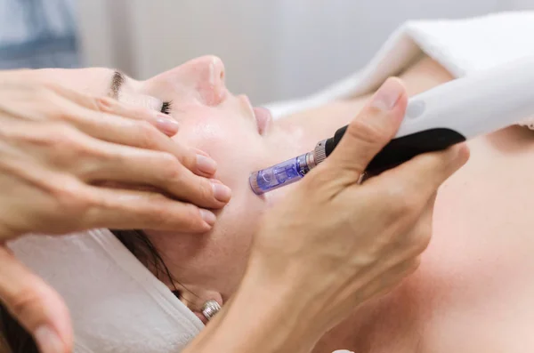 Hardware Kosmetologie Mesotherapie Dermapen Behandlung Der Gesichtszone Gesichtsverjüngung Nahaufnahme — Stockfoto