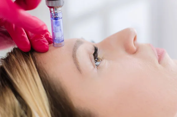 Cosmetología Hardware Mesoterapia Primer Plano Mujer Joven Recibiendo Tratamiento Zona —  Fotos de Stock