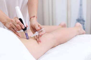 Woman having mesotherapy of her legs, with dermapen and vitamines for hydratation at beauty spa salon. clipart
