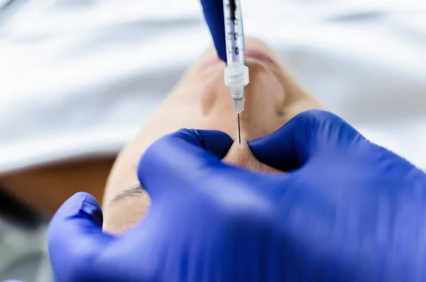 Zbliżenie Dokonywanie Botox Wstrzykiwań Kobiece Nos Kosmetolog — Zdjęcie stockowe