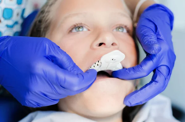 Primo Piano Della Giovane Paziente Che Prende Impronte Dentali Dal — Foto Stock