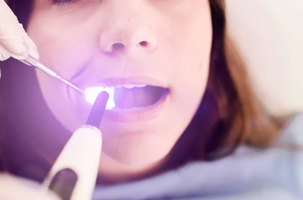 Nahaufnahme Einer Patientin Der Zahnklinik Zähne Lampe — Stockfoto