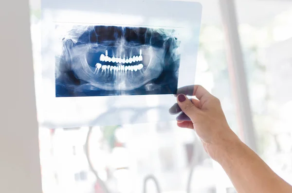 Une Dentiste Tenant Une Radiographie Mâchoire Patient — Photo