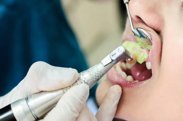 Primo Piano Giovane Paziente Presso Studio Dentistico Ottenere Denti Lucidati — Foto Stock