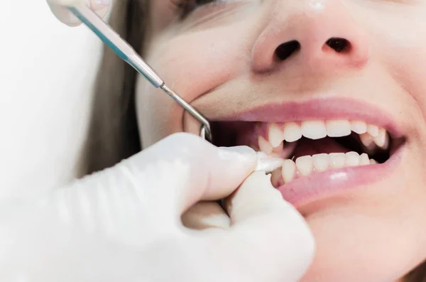 Nahaufnahme Einer Patientin Mit Gaze Mund Beim Zahnarzt — Stockfoto