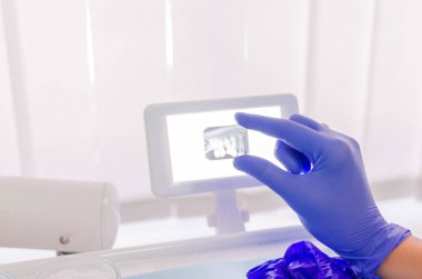 Diş hekimi diş röntgen arıyorsunuz