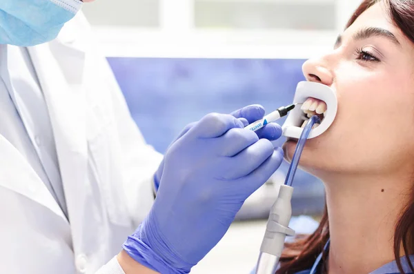 Primo Piano Paziente Femminile Dentista Sbiancamento Denti — Foto Stock