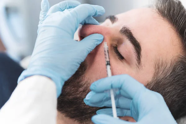 Närbild Ung Man Med Hyaluronsyra Fillers Läpparna — Stockfoto