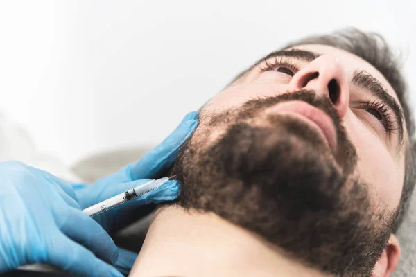 Närbild Ung Man Med Hyaluronsyra Fillers Läpparna — Stockfoto