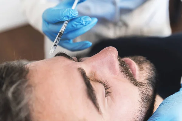 Närbild Ung Man Med Hyaluronsyra Fillers Läpparna — Stockfoto