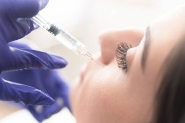 Hastaya anestezi enjekte eden doktorların ellerinin yakın lığı, burun estetiğinin yeni modern noninvaziv prosedürü
