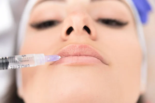 Close Female Lips Injected Medical Substance Syringe — Stock Photo, Image