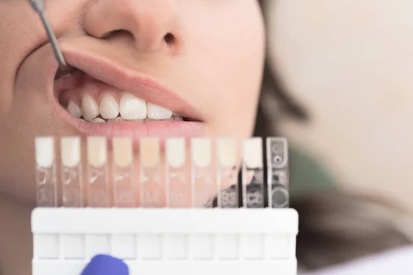 Close Female Patient Dental Clinic Having Her Teeth Checked Whitening — Stock Photo, Image