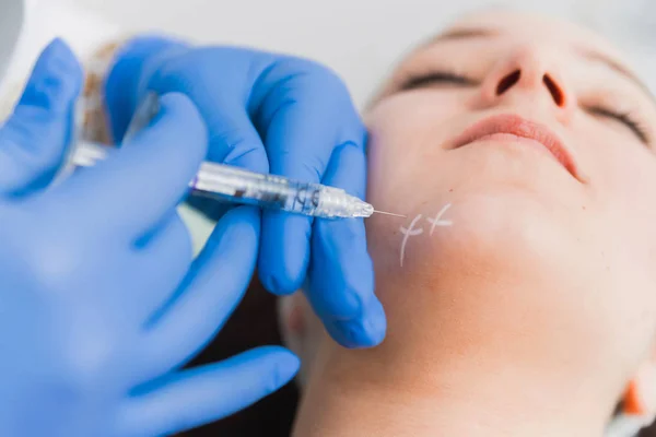 Close Doctors Hands Injecting Hyaluron Patients Chin — Stock Photo, Image