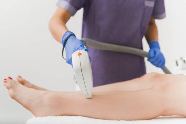 Alt bacaklarında lazer epilasyon işlemi olan kadın hastanın yakın çekim