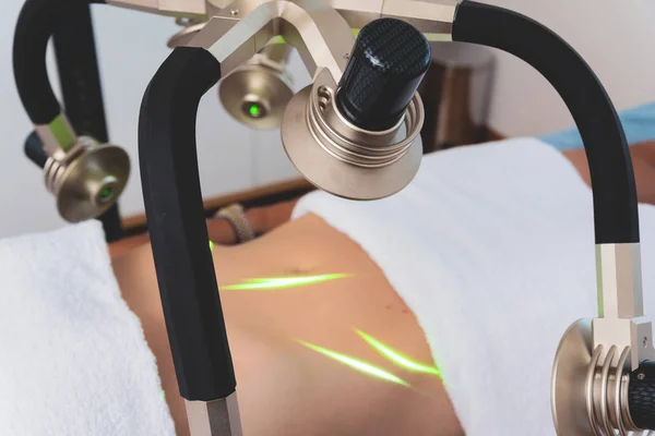 Zavírání Ženských Břišních Pupek Během Neinvazivních Laserových Tvarů Rozštíhlání Léčby — Stock fotografie