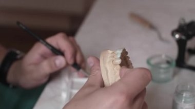 Teknisyen dişçi bir çene protez yapar