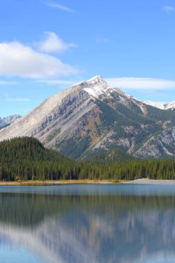 KANANASKIS göl manzara Kanada