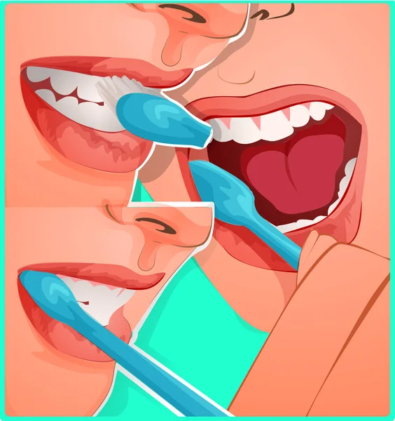 Imagen Vectorial Cómo Cepillar Correctamente Los Dientes Consejo Del Dentista — Archivo Imágenes Vectoriales