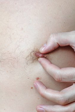 Erkek kıllı meme. Saçlı meme. Kolay erotik ve mizah. Zekâ