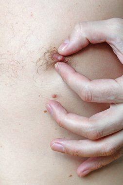 Erkek kıllı meme. Saçlı meme. Kolay erotik ve mizah. Zekâ