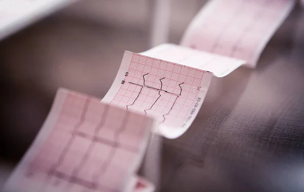 Медична кардіограма надрукована на папері на столі Ліцензійні Стокові Зображення
