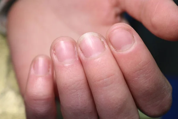 Manicura de uñas de moda en hermosas manos femeninas — Foto de Stock