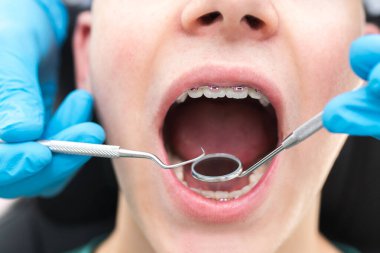 dentist looking and checking orthodontics and braces