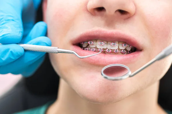 Dentysta Patrząc Usta Narzędziami Lustro — Zdjęcie stockowe