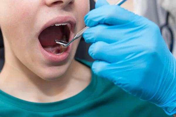 Dentista Com Boca Criança Aberta — Fotografia de Stock