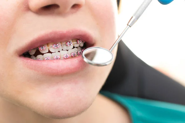 dentist looking at the mouth with tools and mirror