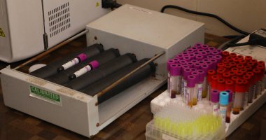 Kan testi tıbbi tüpleri.