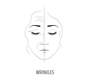 Yüz gençleştirme lazer. Anti-kırışıklık ve anti-aging tedavi. Salon yordamı etkisi. Geuloron asit veya botox facelift için enjeksiyon. Yaşa bağlı cilt bakım kremi