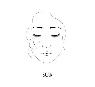 Kozmetik lazer prosedürü için yara izi kaldırma. Bir kızın yüzü