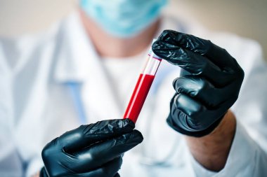 Coronavirüs salgını. Elinde bir şişe kan tutan bir doktorun eli..