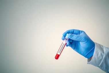 Coronavirüs salgını. Elinde bir şişe kan tutan bir doktorun eli..