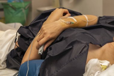 Bir damlalık ve itme uzak düğme için epidural anestezi normal bir doz ile bir teslimat odada kadın