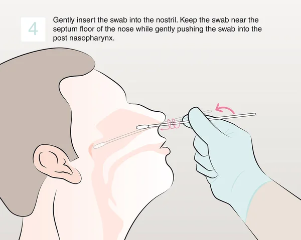 Inserte Suavemente Hisopo Fosa Nasal Mantenga Hisopo Cerca Del Suelo — Archivo Imágenes Vectoriales