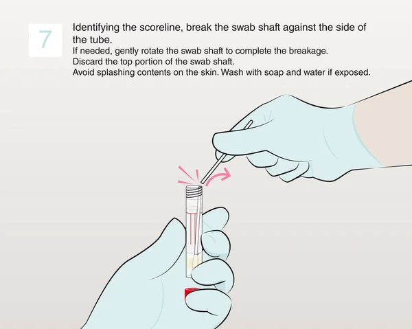 Step Identifying Scoreline Break Swab Shaft Side Tube Needed Gently Stock Vector