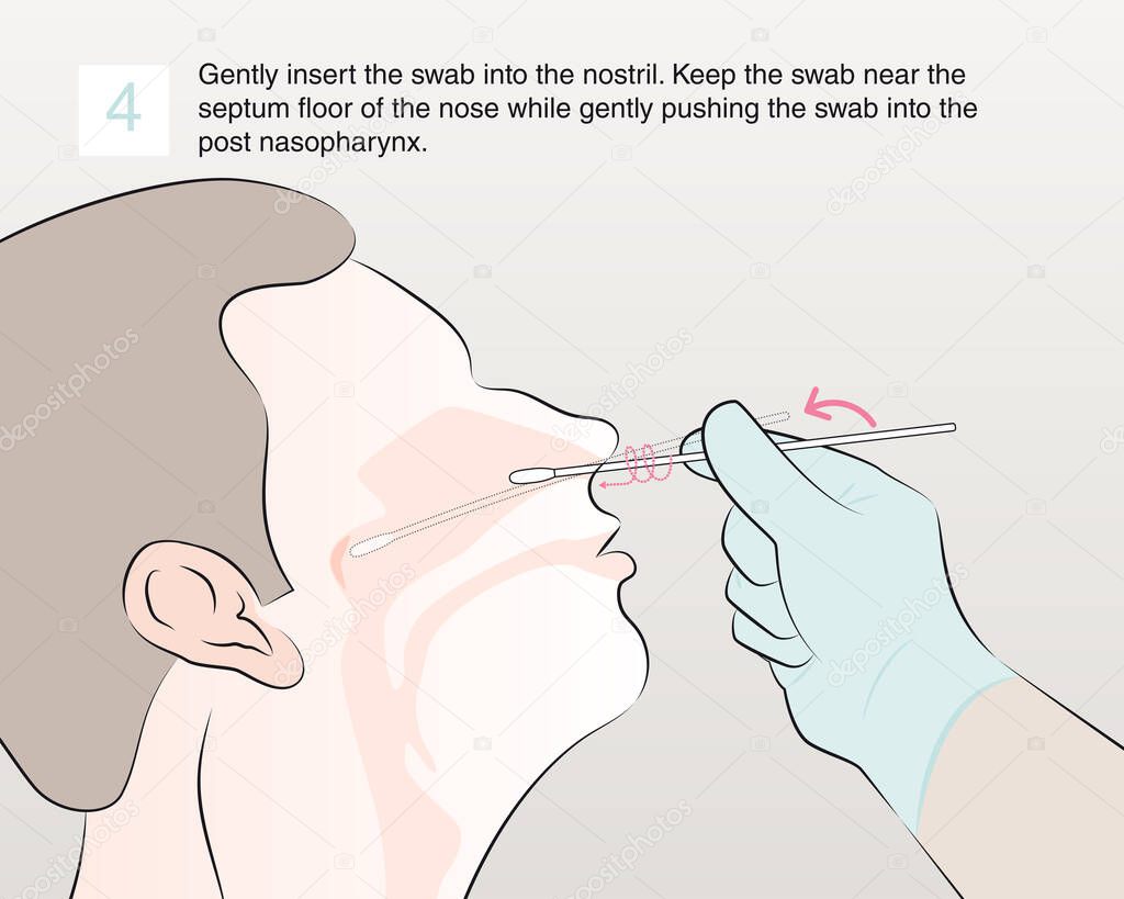 Gently insert the swab into the nostril. Keep the swab near the septum floor of the nose while gently pushing the swab into the post nasopharynx. step 4