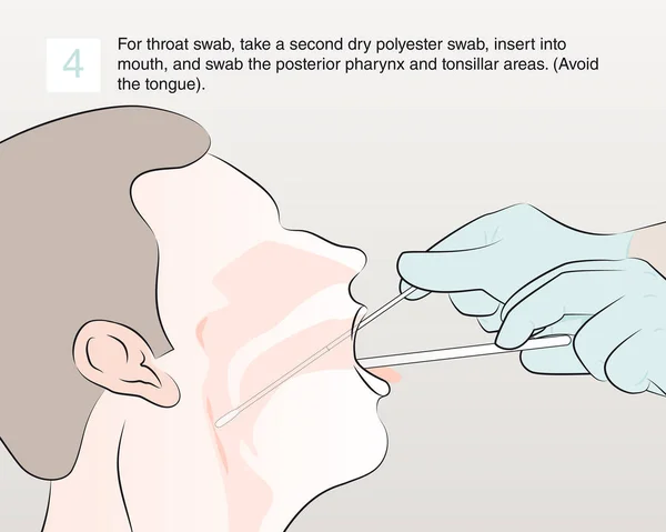 Étape Pour Écouvillonnage Gorge Prélevez Deuxième Écouvillonnage Sec Polyester Insérez — Image vectorielle