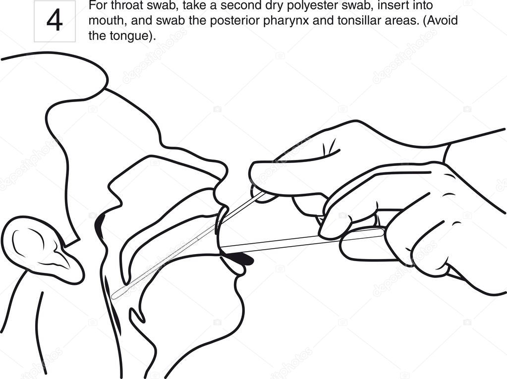 step 4 : For throat swab, take a second dry polyester swab, insert into mouth, and swab the posterior pharynx and tonsillar areas. (Avoid the tongue). line drawing